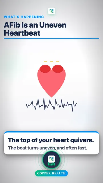 AFib Can Raise Stroke Risk