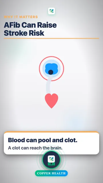 How to Check Your Pulse