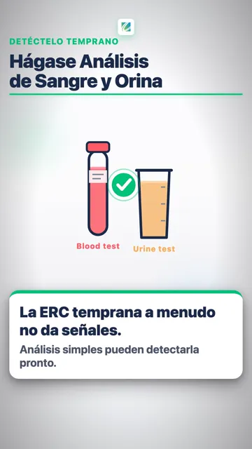 Una cosa más