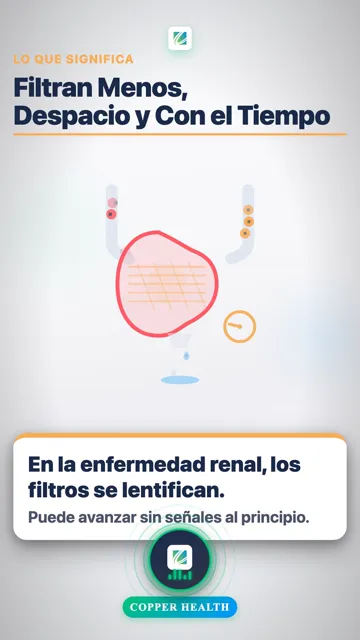 El Azúcar Alta Puede Dañar los Filtros