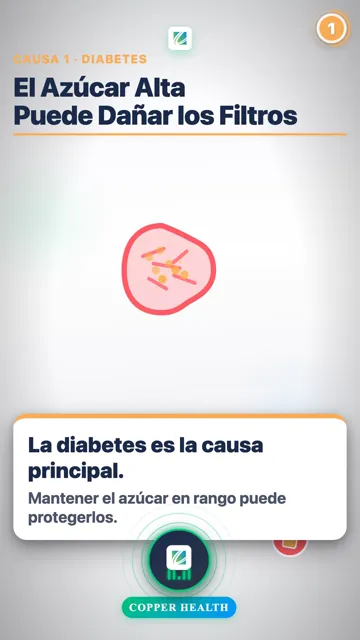 La Presión Alta Daña los Filtros
