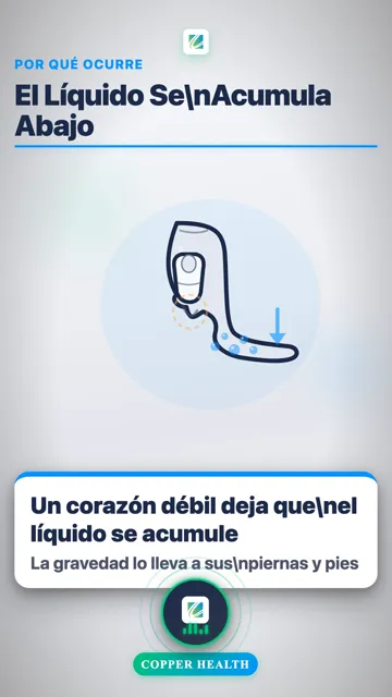 Elevación