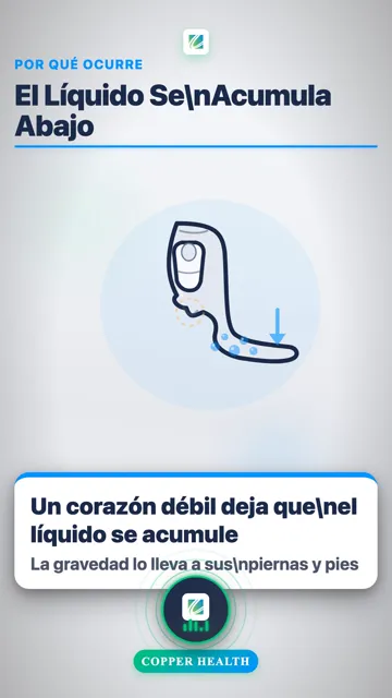 Eleve Sus Piernas