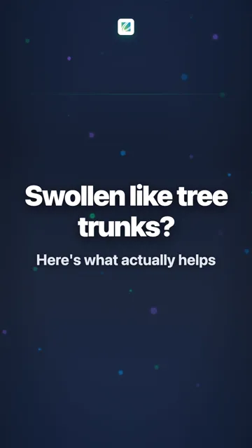 Swollen like tree trunks?