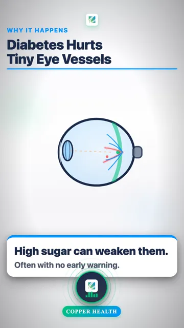 Dilated Eye Exam