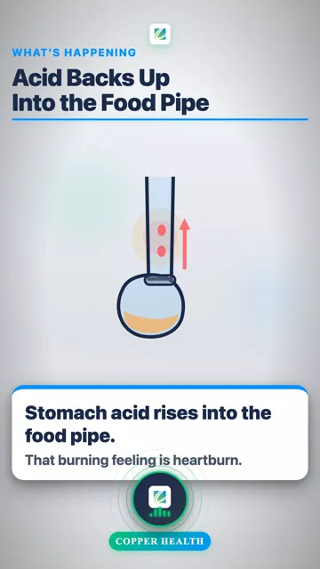 Acid Backs Up Into the Food Pipe
