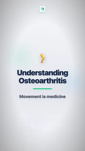 Understanding Osteoarthritis