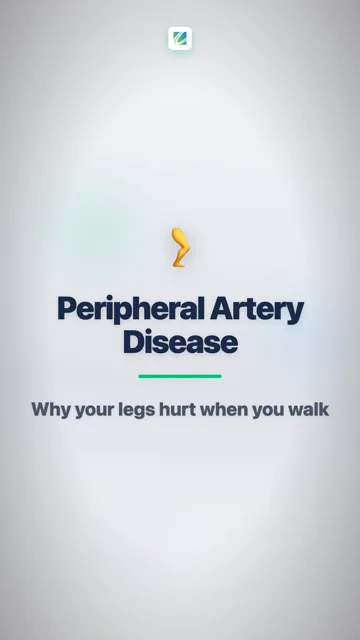 PAD Is Narrowed Leg Arteries