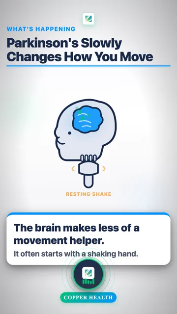 It Can Change Movement 4 Ways