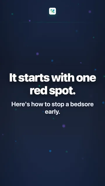 Preventing Bedsores