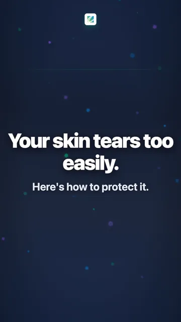 Your skin tears too easily.