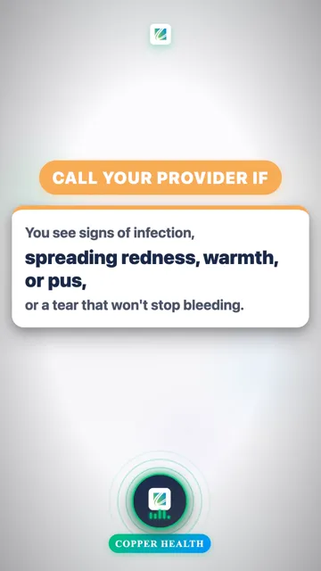 Watch for Infection