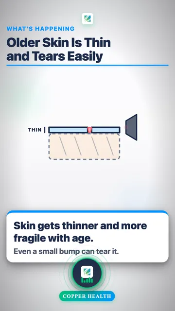 3 Easy Ways to Prevent Tears