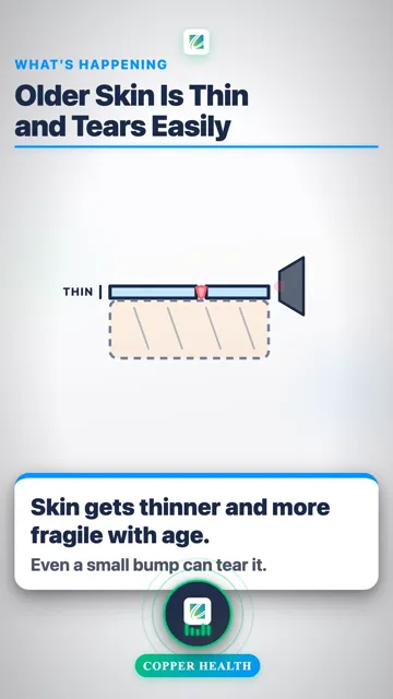 Moisturize Every Day
