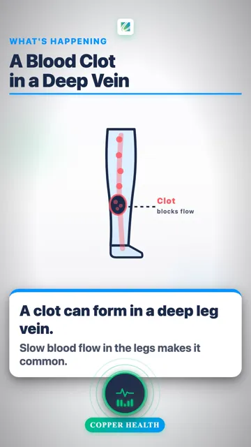 3 Leg Warning Signs