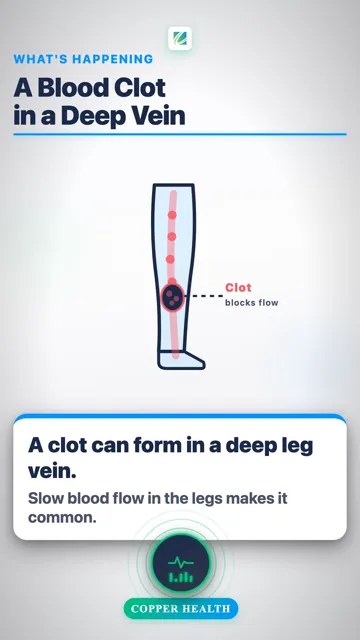 New Swelling in One Leg